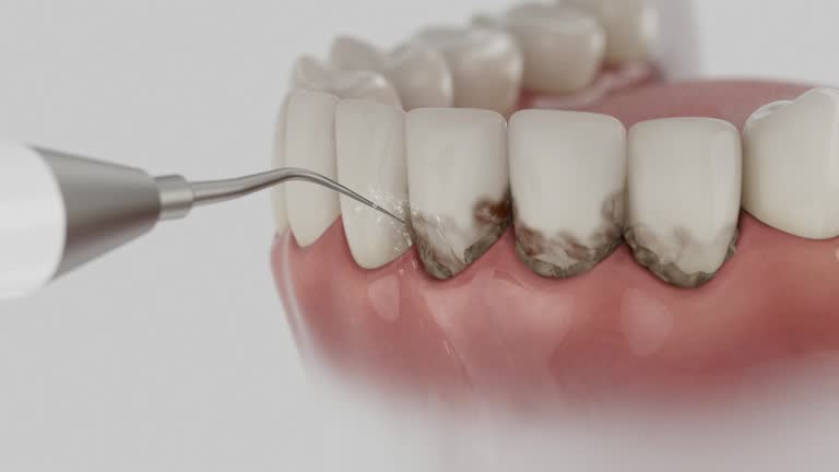 Trusted Dental Crowns And Bridges service in Colonial Park, PA - Dentist Open Now